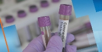 Днес още 13 с COVID-19, вирусът уби 81-годишен мъж Днес още 13 с COVID-19, вирусът уби 81-годишен мъж