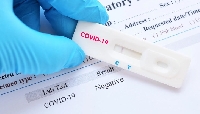 19 новозаразени с COVID-19 в Пиринско от 157, 9 нови жертви на вируса 19 новозаразени с COVID-19 в Пиринско от 157, 9 нови жертви на вируса