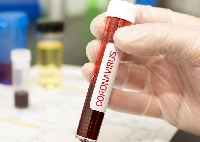 Над 3,3 млн. са новозаразените в света за една седмица от коронавирус