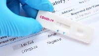 Почти 200 новозаразени с COVID-19 за последното денонощие в Пиринско, 52 жертви на вируса в страната