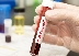 СЗО: Пандемията от коронавирус може да е под контрол до месеци