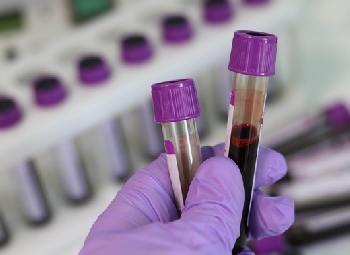 Само двама с ковид в Пиринско за последните 24 часа, 57 са в страната