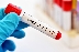 Медик: Няма смисъл от тестовете за антитела