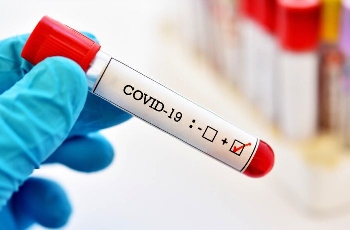 Намаляват времето на изолация за болните с COVID-19 на 10 дни