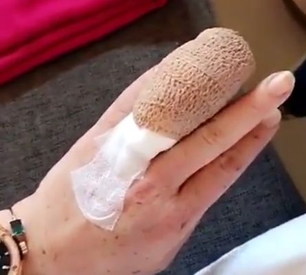 Линдзи Лоън почти си отряза пръста